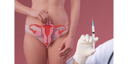 Botox for Vaginsmus