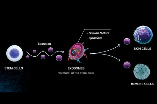 Exosomes Therapy
