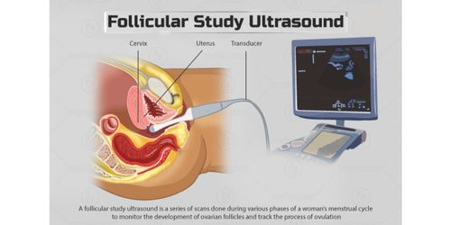 Follicular study ultrasound
