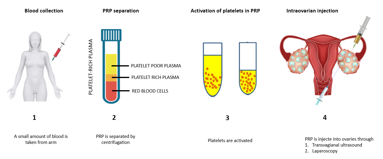 PRP Therapy